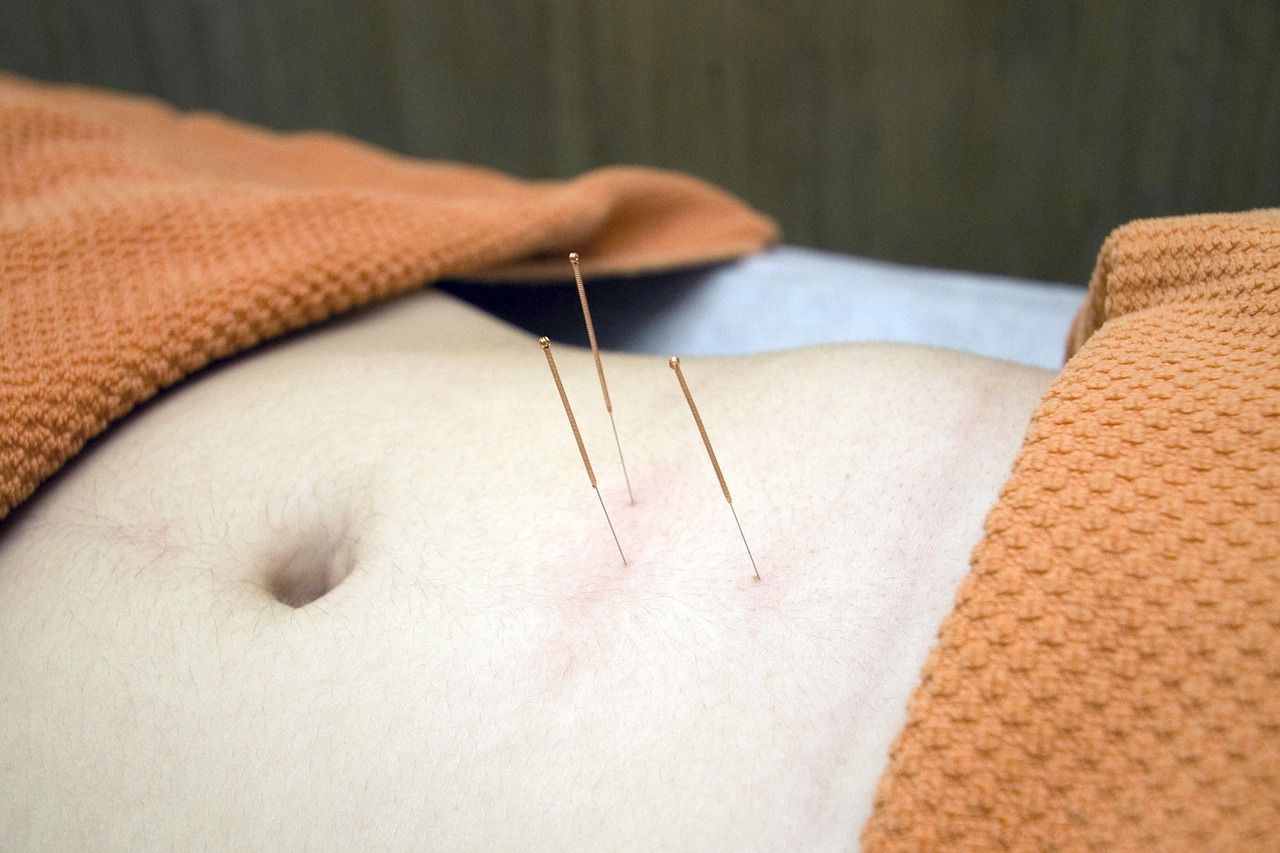 Acupuntura Sistêmica